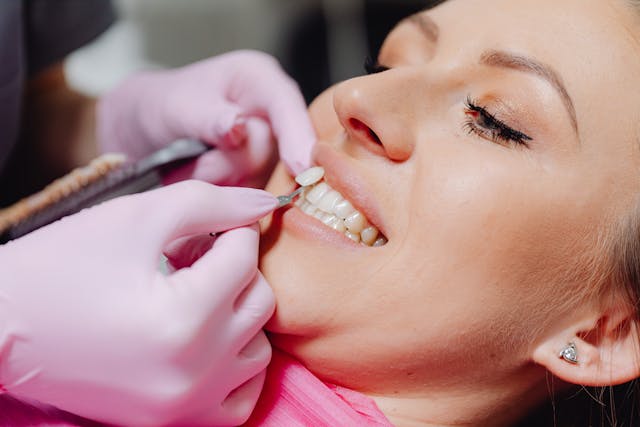 faccette dentali